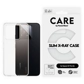 Custodia X-Ray per Xiaomi 15T Pro 5G, Trasparente, CARE